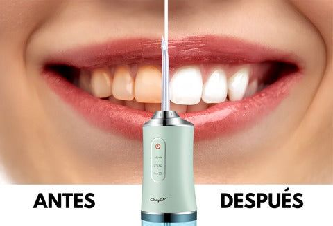 HidroSmile™ Irrigador bucal